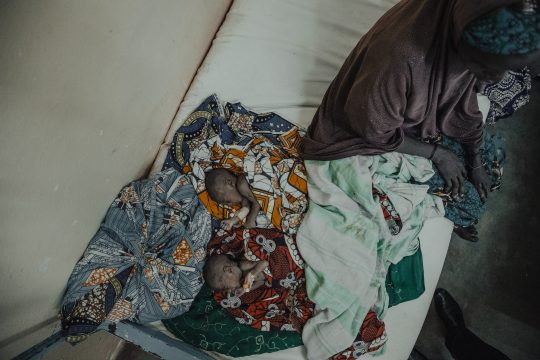 Deux jumeaux gravement malnutris et leur mère à l'hôpital national de Zinder