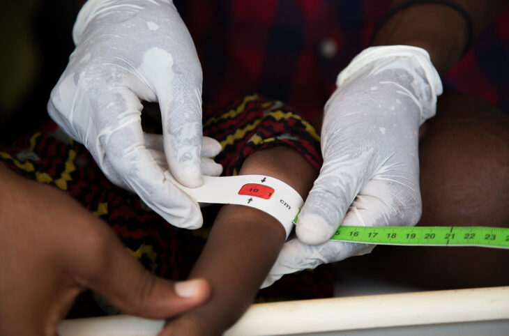 Agadez première région touchée par la malnutrition