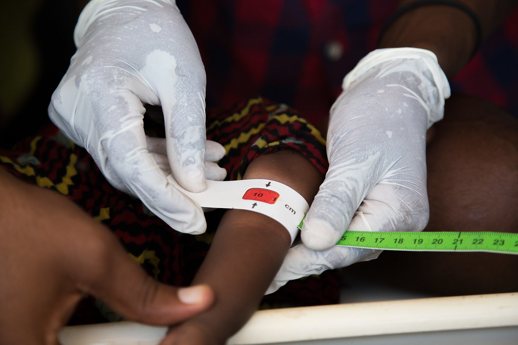 Agadez première région touchée par la malnutrition