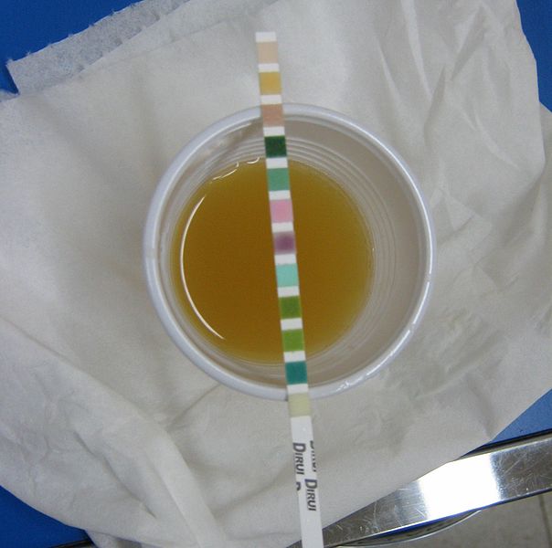 Prévention de l’infection urinaire, chez l’homme et la femme