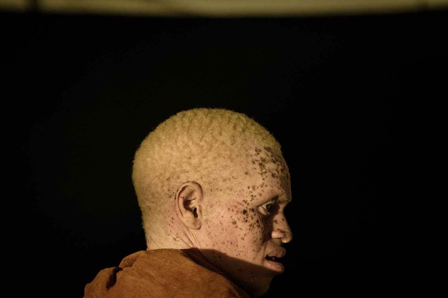 Zinder/ Il n’y a pas eu d’enlèvement d’albinos à Dan Tchiao