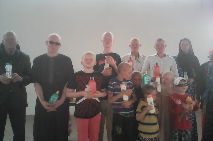 Albinos du Niger : « il faut combattre les préjugés à l’école » plaide la présidente de leur association