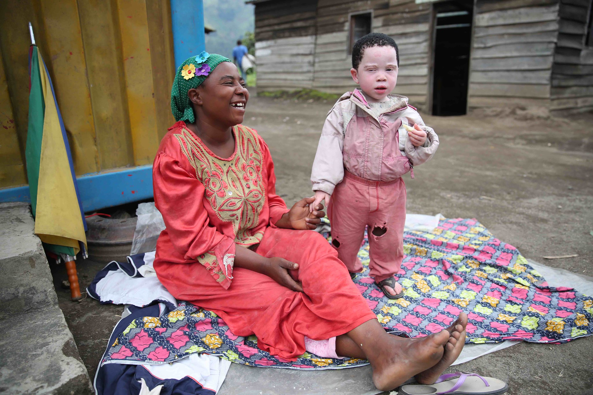 Célébration de la journée internationale de sensibilisation sur l’albinisme
