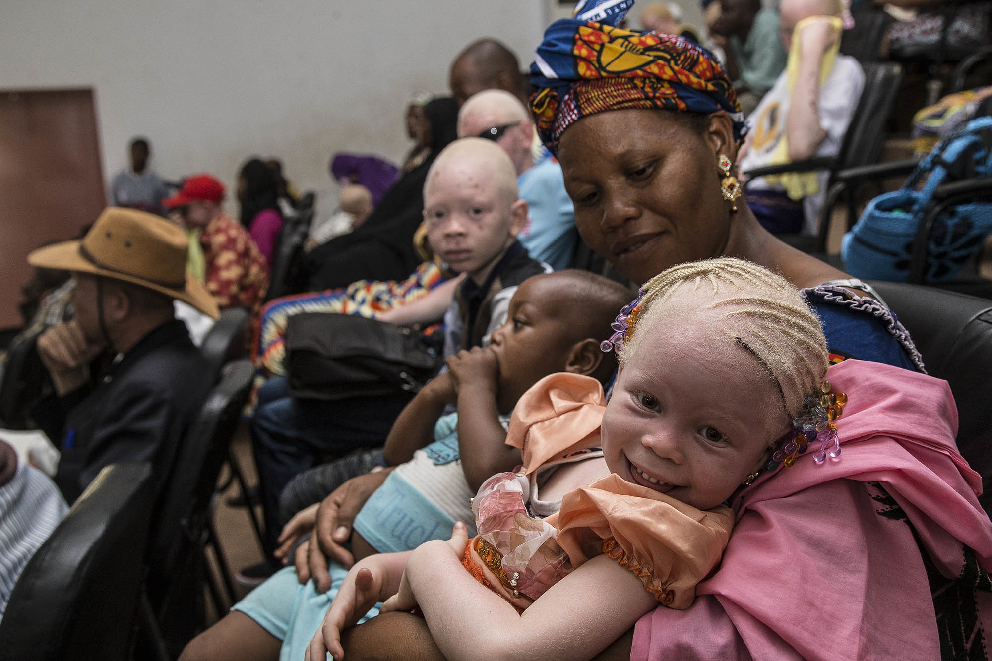 La communauté albinos célébrée ce 13 juin dans le monde