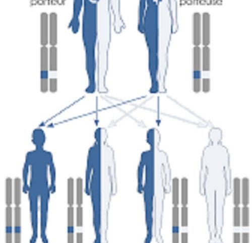 Santé / Un nigérien sur quatre est drépanocytaire
