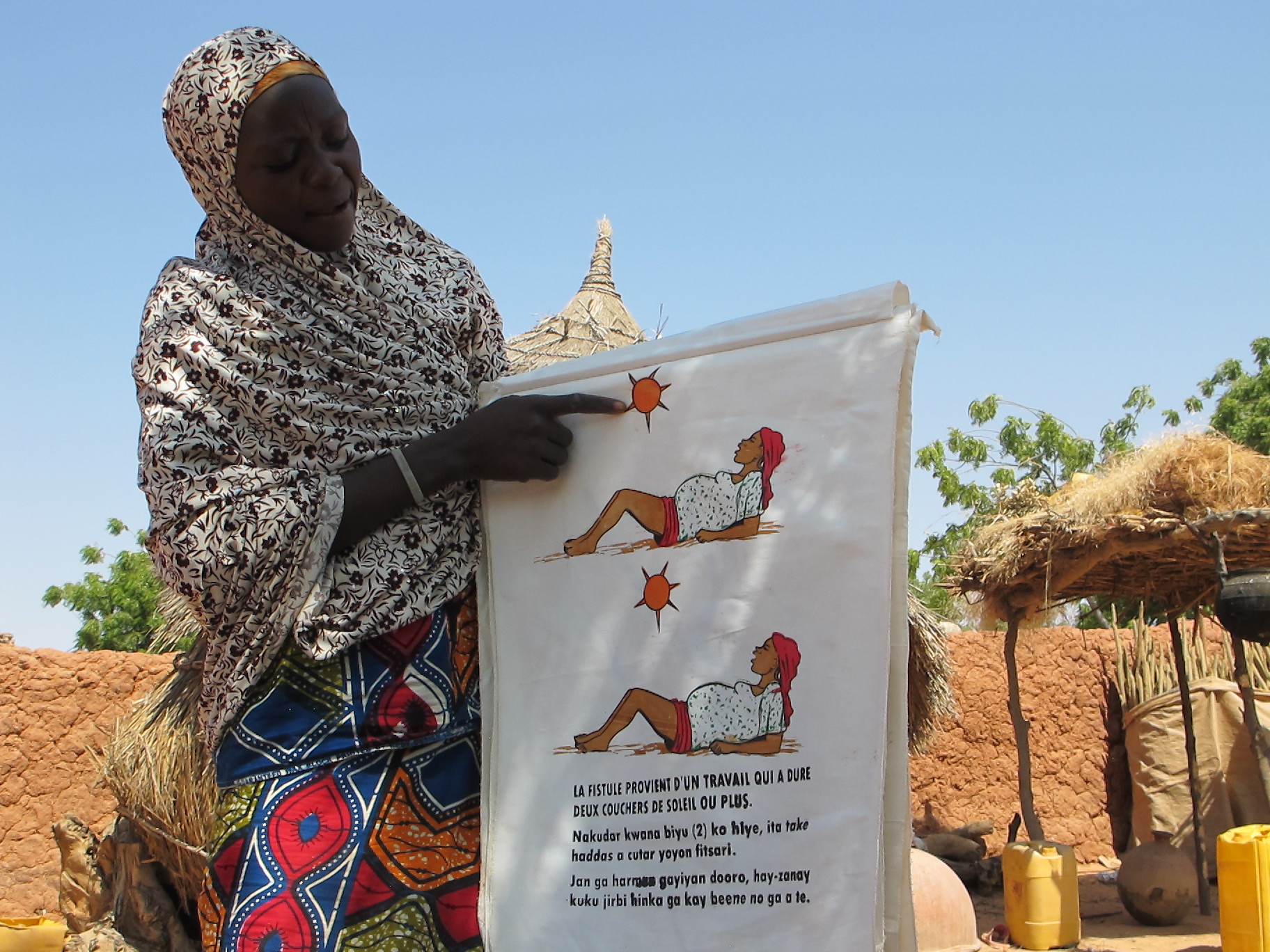 Fistule obstétricale au Niger : les traitements possibles